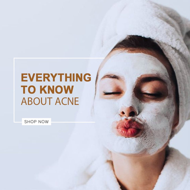 Everything to know about Acne!