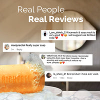 Richfeel Calendula Anti Acne Soap 75 G Pack of 4