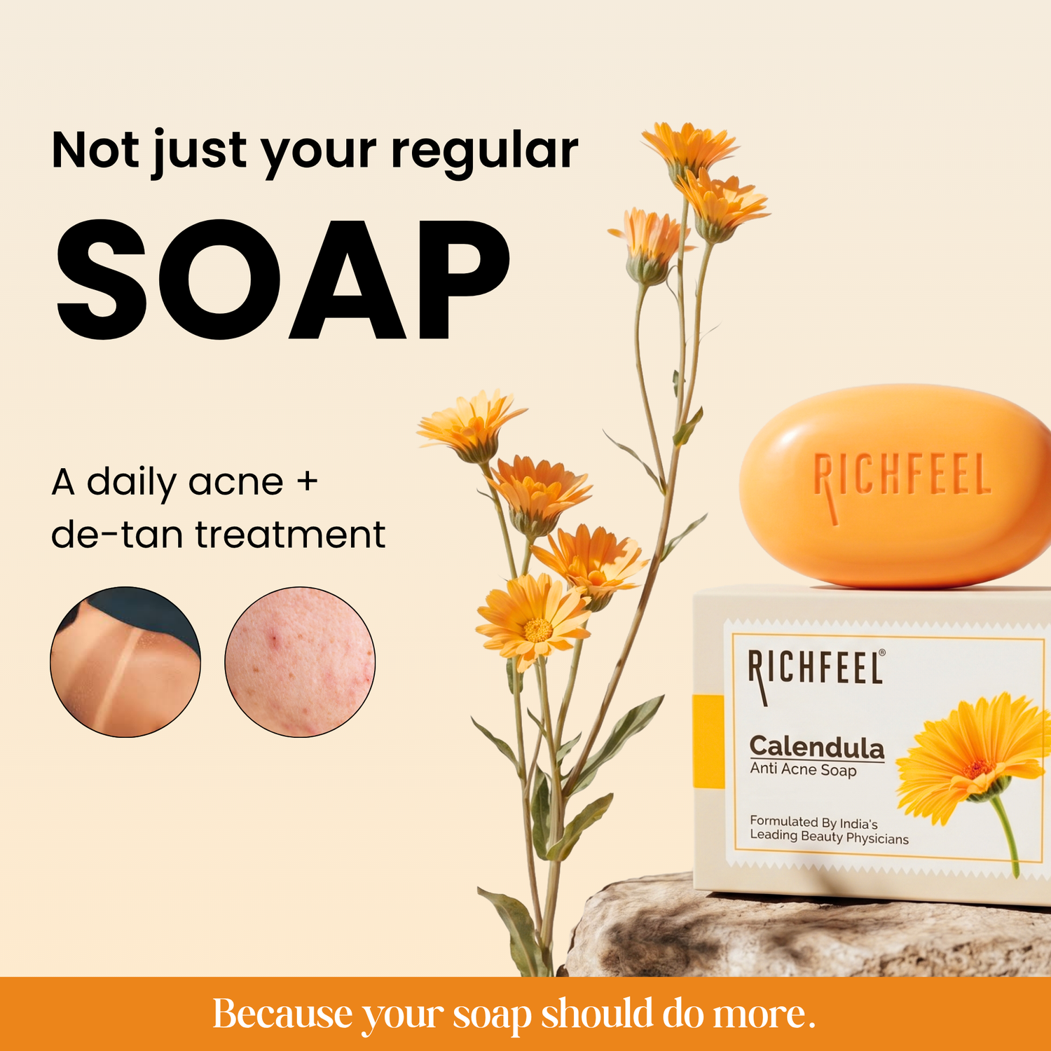 Richfeel Calendula Anti Acne Soap 75 G Pack of 8