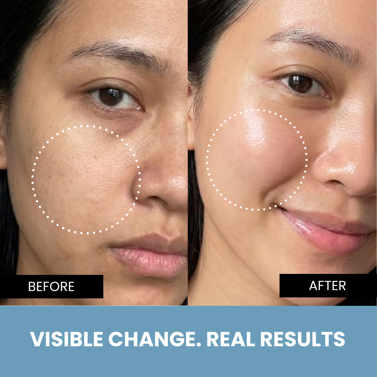 Richfeel Pearl Facial Kit 30 g