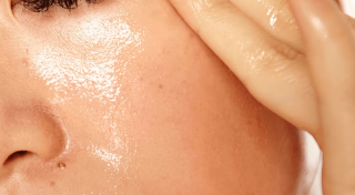 Oily