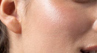 No breakouts