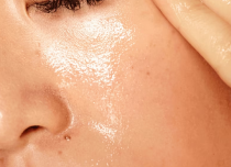 Oily Skin