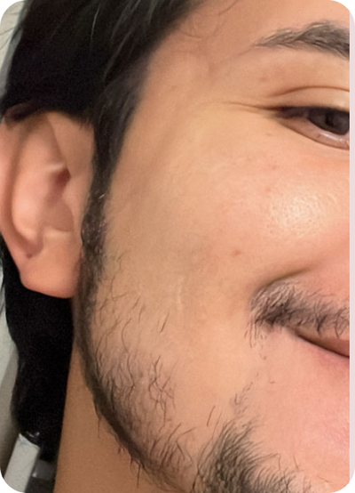 After