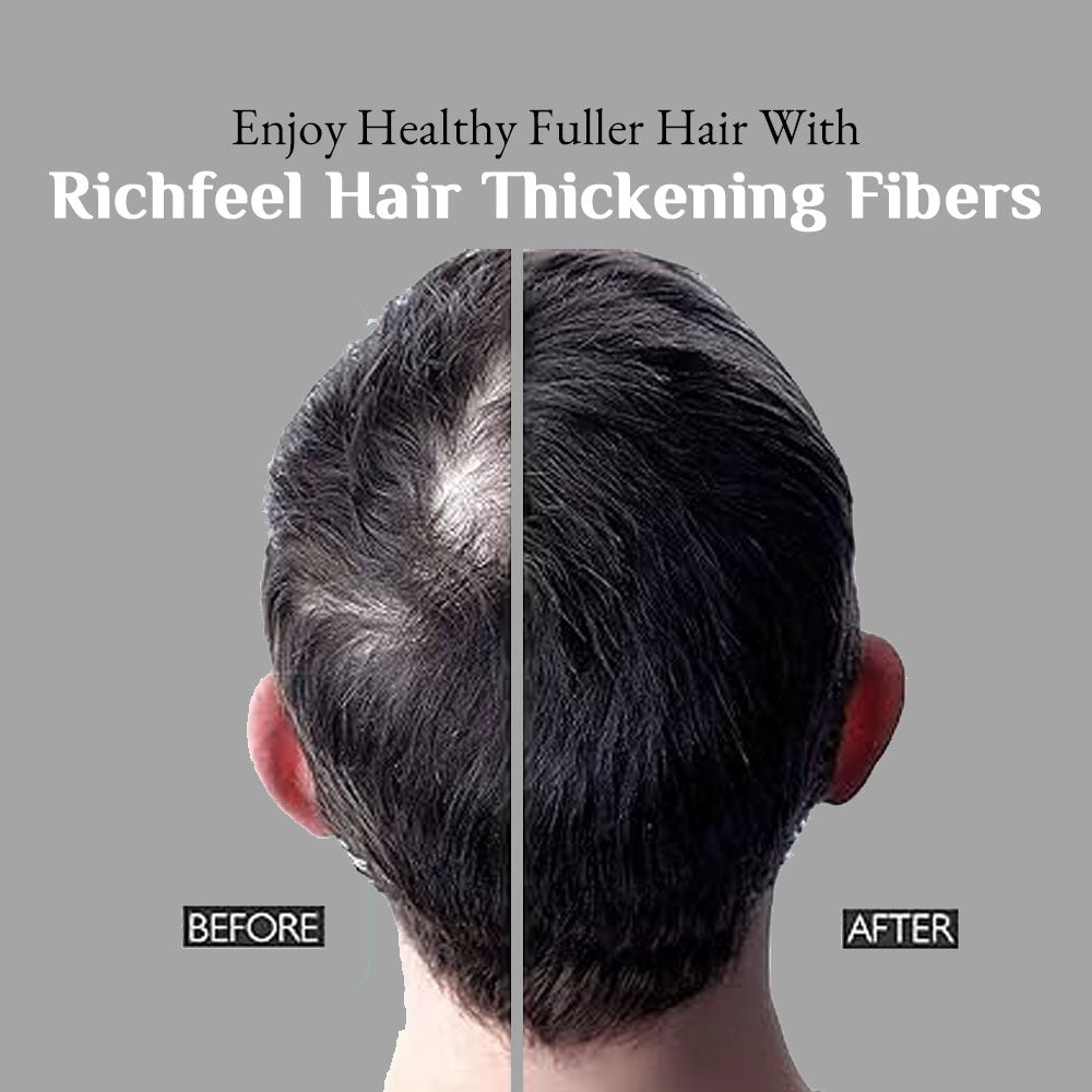 Richfeel Hair Thickening Fibers Black (B1G1) 28gm