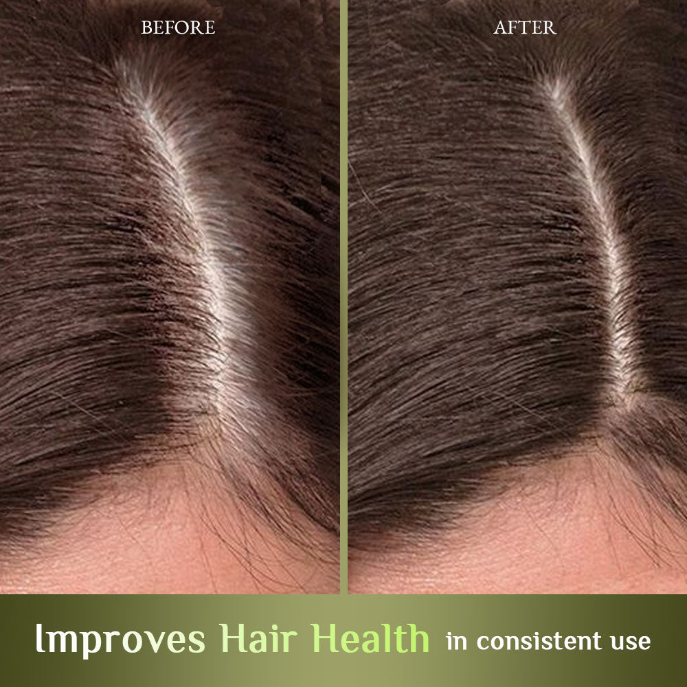 Richfeel Hair Root Nourisher 80 Ml (Pack of 2)