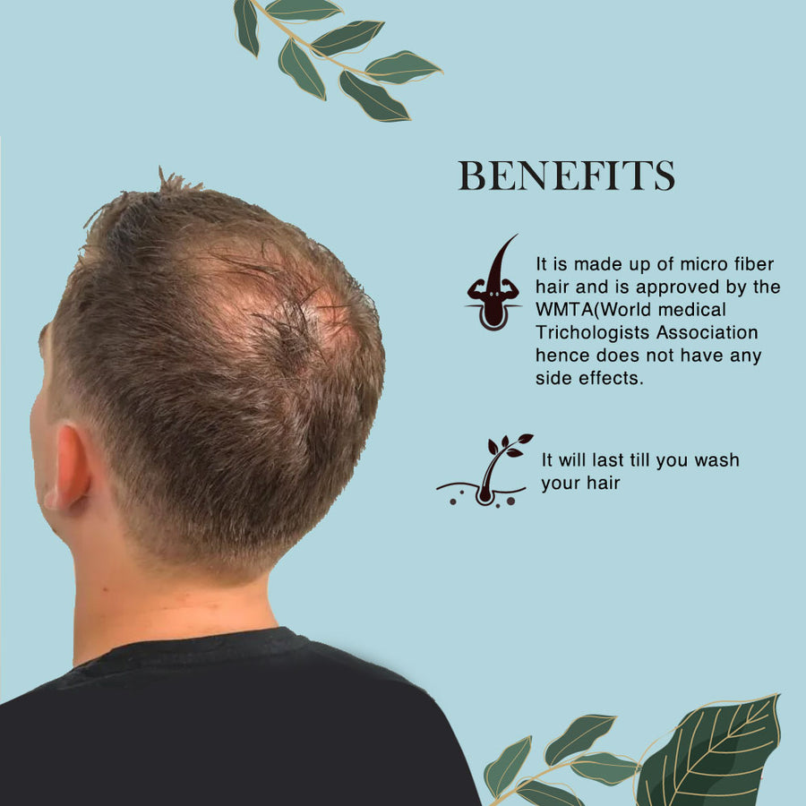 Toppik Hair Fiber Review: This Instantly Fixed My Thinning Hair [2023]